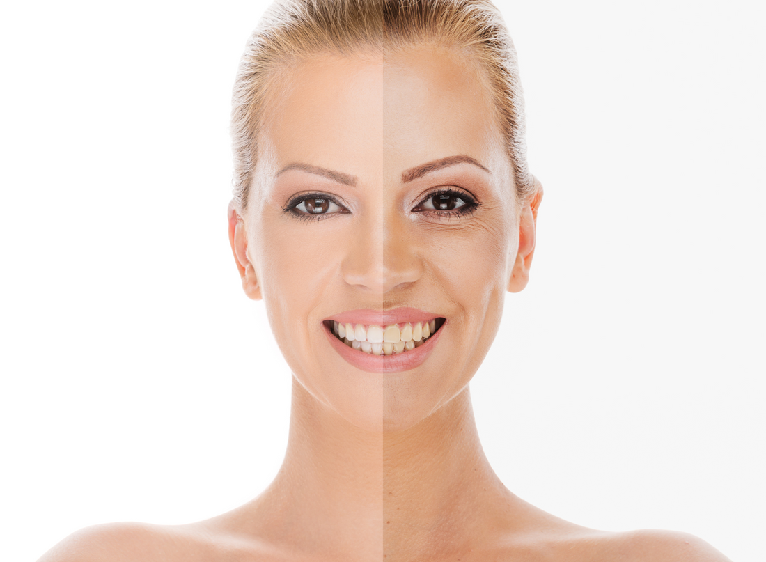 Is Vitamin C Important for Skin Health?